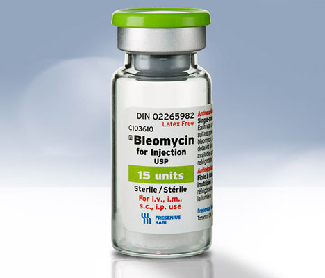 Bleomycin for Injection